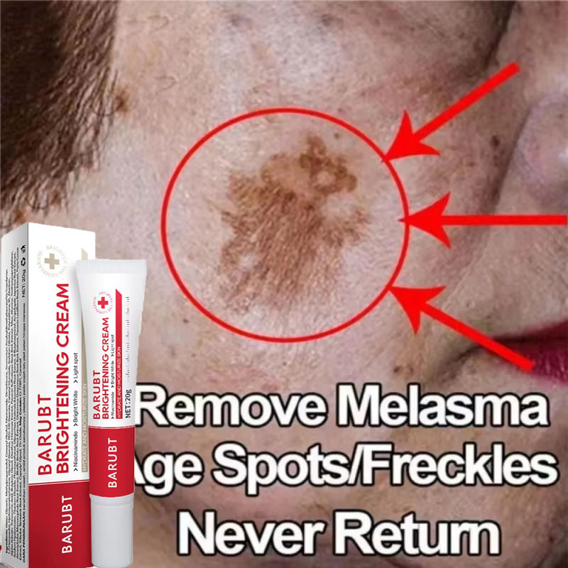 Vitamin C Serum Face - 強力なシミ除去美白クリーム 肌を素早く明るくする メラニン色素沈着、肝斑、黒ずみを解消 韓国スキンケア