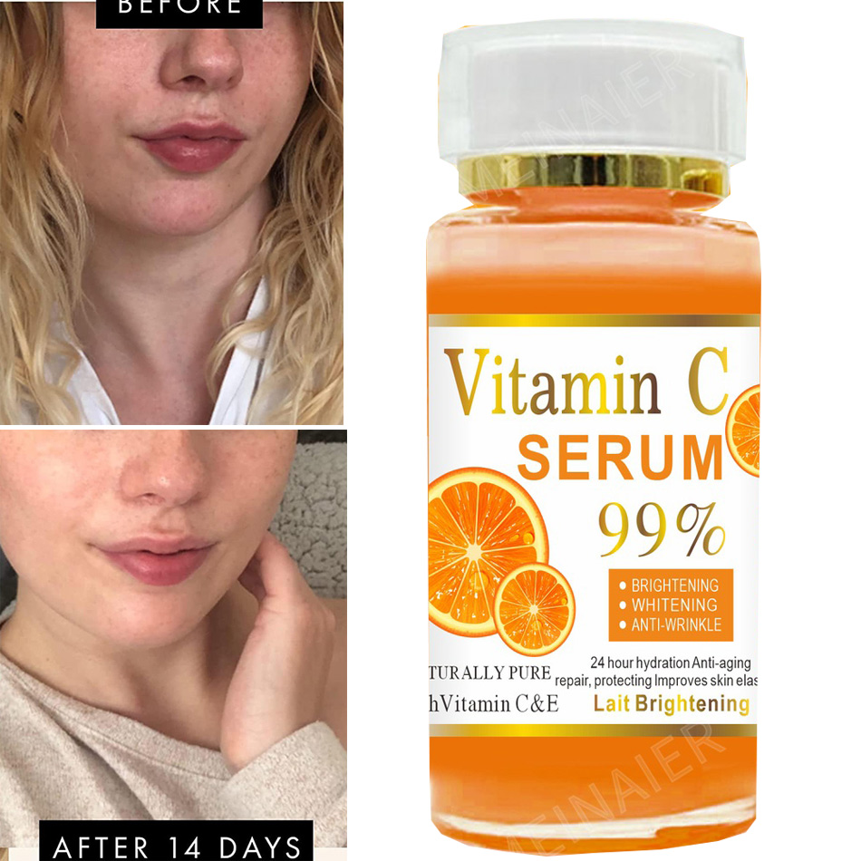 Vitamin C Serum Face - スーパービタミンcホワイトニングセラム,アンチエイジング,フェイシャルオイル,チークレス,しわ防止,栄養液,120ml