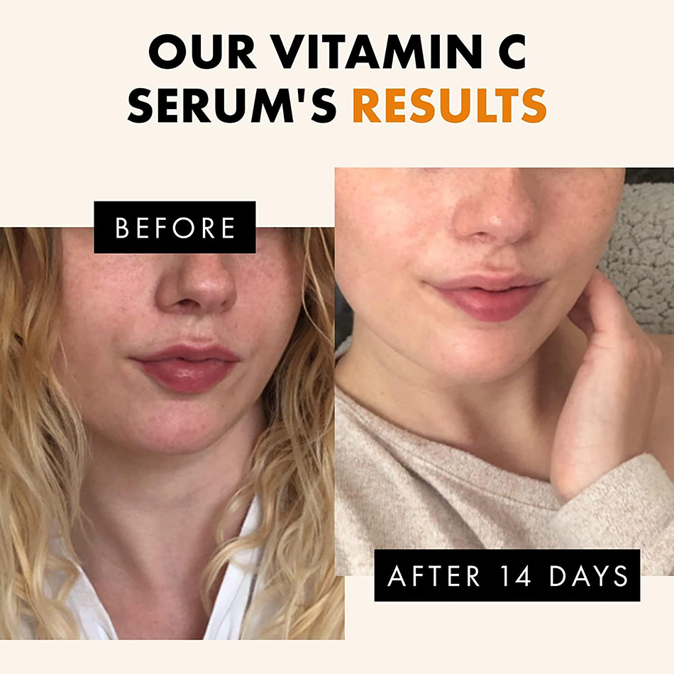 スーパービタミンcホワイトニングセラム,アンチエイジング,フ - Vitamin C Serum Face のレビューと価格